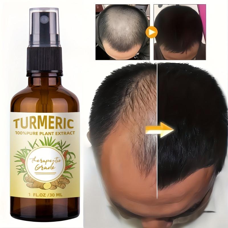 30ml Ginger Hair Care Essential Spray Strengthen Hair Root Ginger Serum