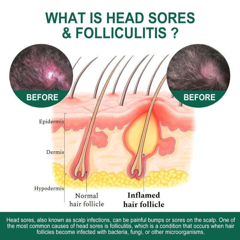 Deep Cleansing Scalp Care for Soft and Repairing Hair
