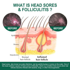 Deep Cleansing Scalp Care for Soft and Repairing Hair