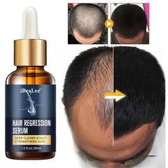 30ml Hair Regression Serum for Healthy Hair