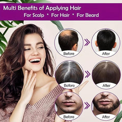 30ml Rosemary Essential Hair Care For All Hair Types