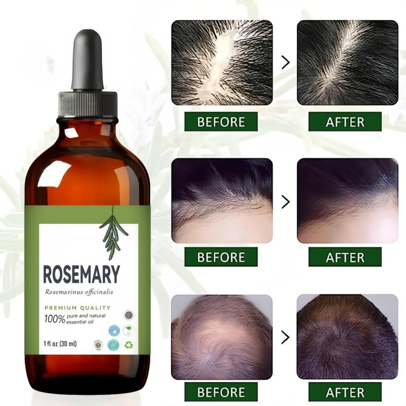 30ml Rosemary Hair Care Essential Oil