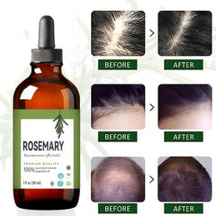30ml Rosemary Hair Care Essential Oil