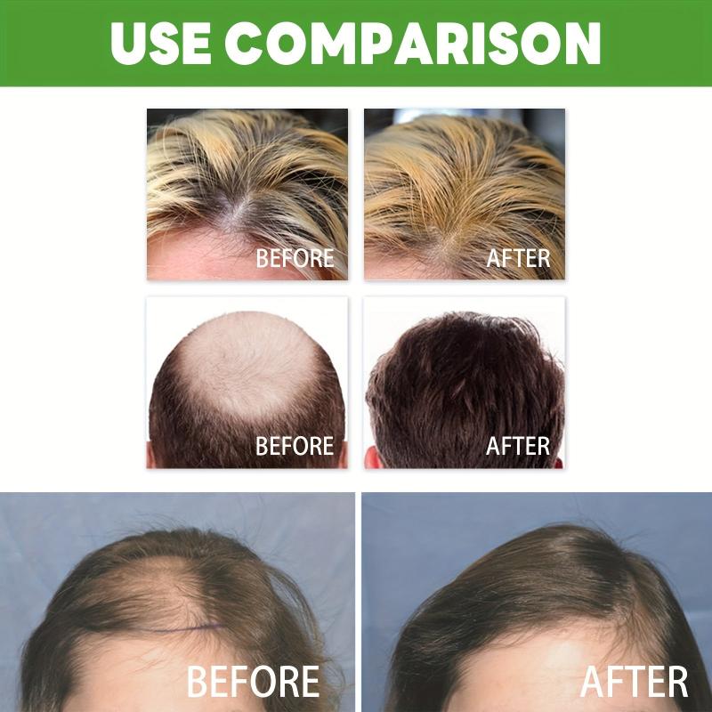 30ml Hair Tonic Spray Strengthens and Boosts Hair Care