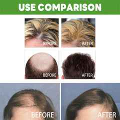 30ml Hair Tonic Spray Strengthens and Boosts Hair Care