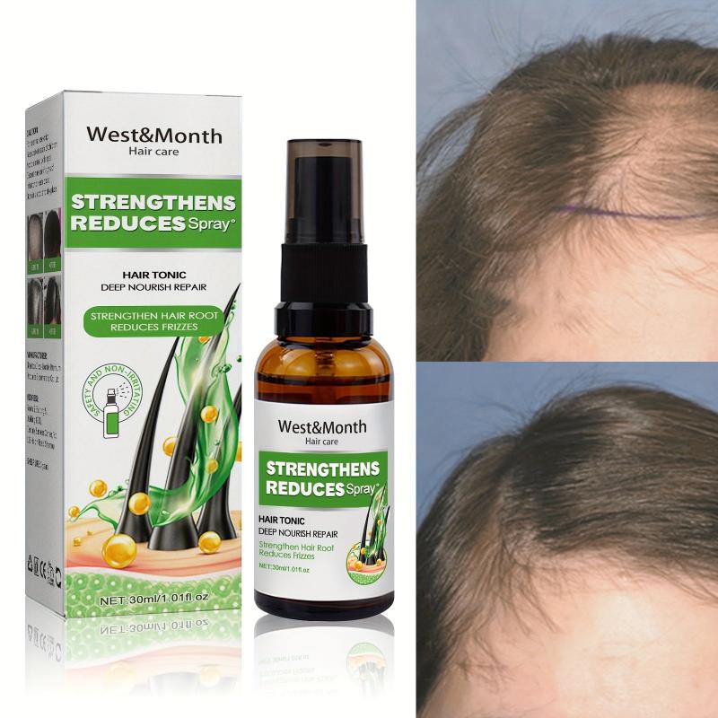 30ml Hair Tonic Spray Strengthens and Boosts Hair Care