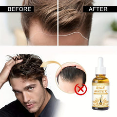 Rice Water Hair Spray Hair Essence Hair Care For All Hair Types