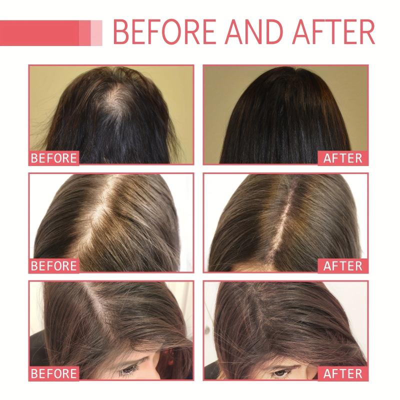 Hair Oil for Moisturized Roots & Strength, Essential Care for All Hair Types