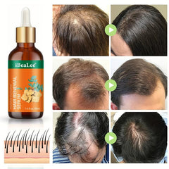 30ml Ginger Hair Renewal Serum for Men and Women