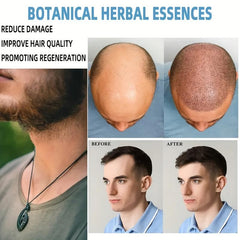 30ml Ginger Hair Renewal Serum for Men and Women