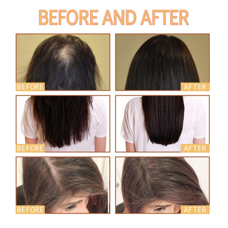 Ginger Hair Care Shampoo & Conditioner Set