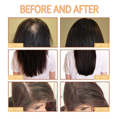 Ginger Hair Care Shampoo & Conditioner Set