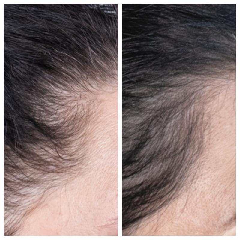 30ml Rosemary Hair Essential Oil for Healthy Hair Care