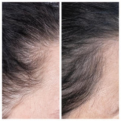 30ml Rosemary Hair Essential Oil for Healthy Hair Care