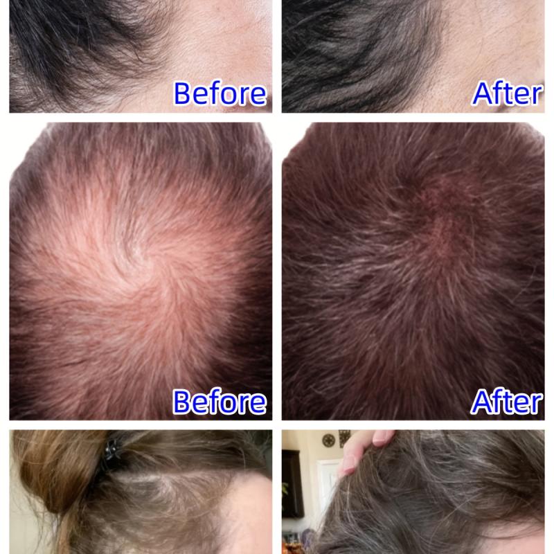 30ml Rosemary Essential Oil for Hair & Skin Care
