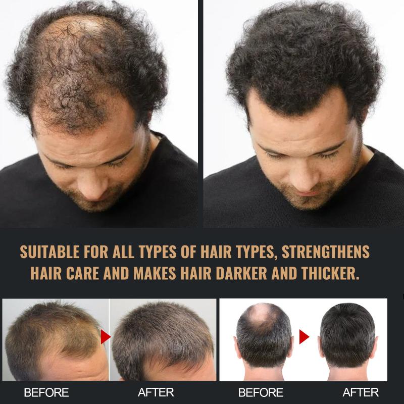 Dense Hair Shampoo for Fluffy Hair Control