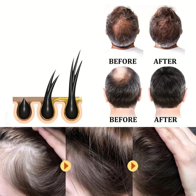 30ml Ginger Hair Repair Oil For Dry & Damaged Hair