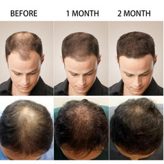 30ml Hair Serum for Instant Darkening and Strengthening