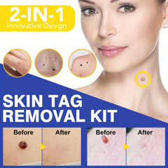 Skin Tag Cleanser Removal Tool with 48 Micro & Regular Safe Natural Skin Care