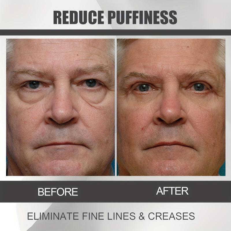 Caffeine Eye Cream with Niacinamide - Ideal Gift for Daily Use