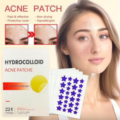 Colorful Star Acne Absorbing Patches Hydrocolloid Acne Patches
