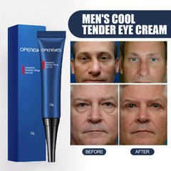 Men's Eye Cream Reduce Puffiness Wrinkles Dark Circles Crows Feet