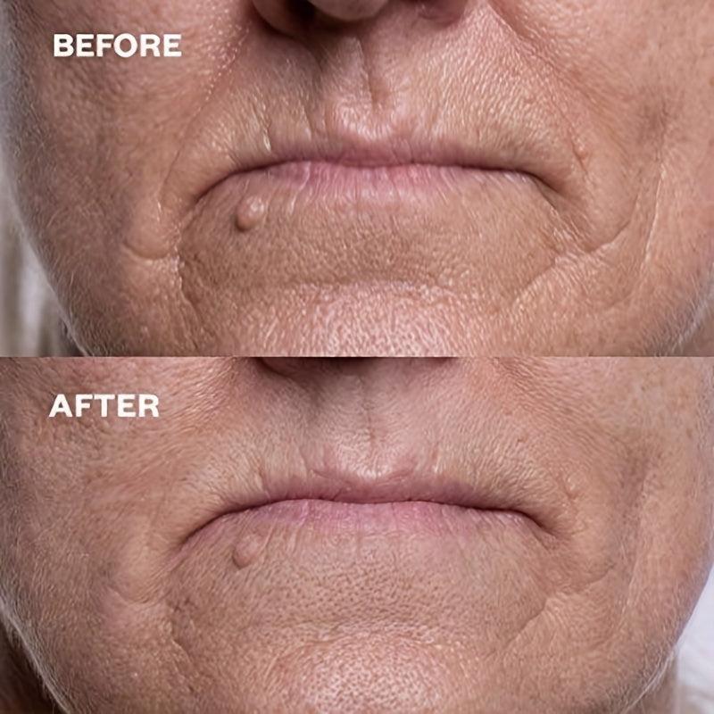 2pcs Reusable Silicone Lip Wrinkle Repair Stickers