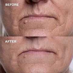 2pcs Reusable Silicone Lip Wrinkle Repair Stickers
