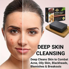 Organic African Soap w/ Cocoa Butter & Vitamin E Deep Cleans