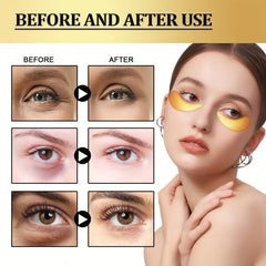 Golden Snail Collagen Eye Mask 60-Pack Hyaluronic Acid Targets Dark Circles