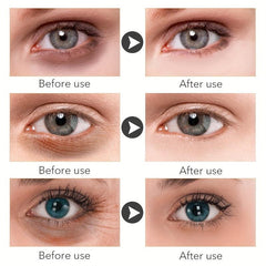 Rewind Eye Cream Dark Circles Wrinkles Puffiness