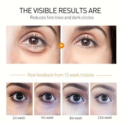 Anti-Wrinkle Eye Cream Diminishes Fine Lines Dark Circles Serum for Baggy Eyes