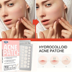 Acne Pimple Patch 72 Pcs Hydrocolloid Spot Stickers Vegan