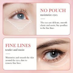 60pcs Rose Hyaluronic Acid Eye Mask for Dark Circles and Puffiness