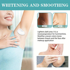 Dark Spot Remover & Moisturizer for Underarms & Private Parts 1oz