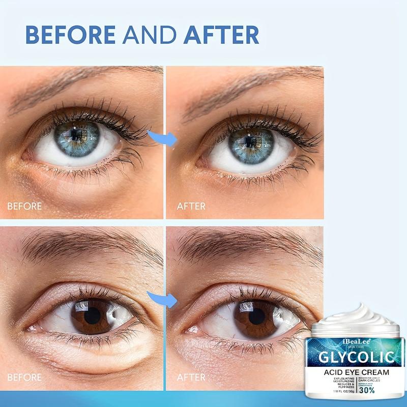 Eye Cream Improve And Firm Eye Skin Reduce Aging 30g