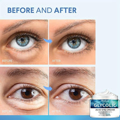Eye Cream Improve And Firm Eye Skin Reduce Aging 30g