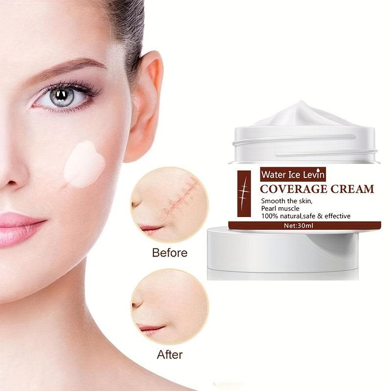 Acne Scar Cream 30ml Anti-inflammatory & Repairing Natural Safe Effective
