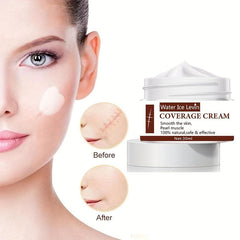Acne Scar Cream 30ml Anti-inflammatory & Repairing Natural Safe Effective