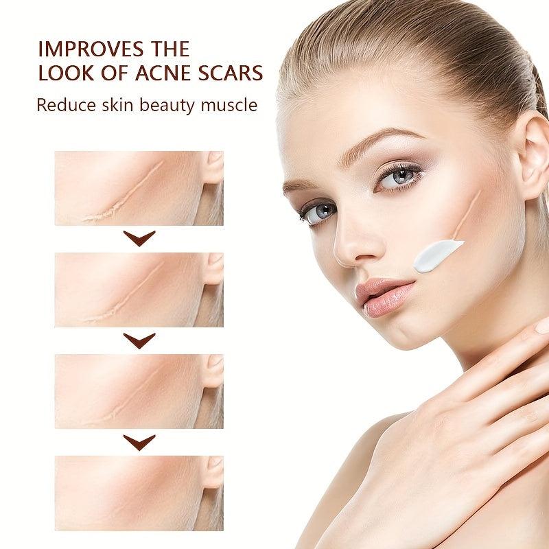 Acne Scar Cream 30ml Anti-inflammatory & Repairing Natural Safe Effective