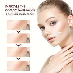Acne Scar Cream 30ml Anti-inflammatory & Repairing Natural Safe Effective