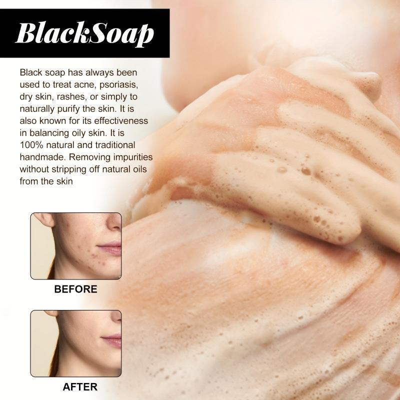 Acne Repair Shea Butter Soap - Cleans Pores, Moisturizes, Smoothes Skin
