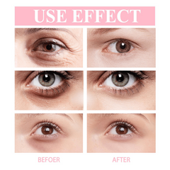 Retinol Eye Cream Firming & Hydrating Crow's Feet Dark Circles