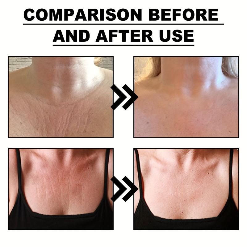 Fade Skin Fine Lines Wrinkles Patch x3