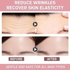 Forehead Smoothing Patches - Reduce Wrinkles - 100% Natural