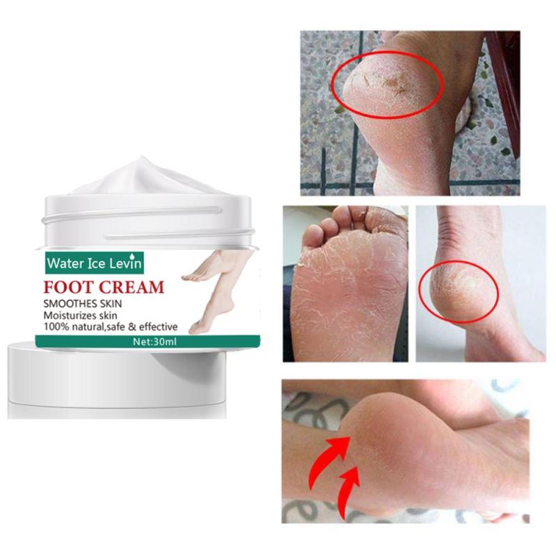 Foot Cream for Dry & Cracked Feet, Softens Legs
