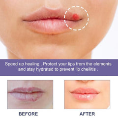 36pcs Lip Care Patch Skin Soothing Moisturizing Restorative Gentle Care Patch