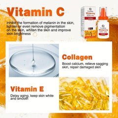 Vitamin C Lotion Moisturizer for Skin Brightening and Age Spot Reduction