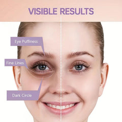 Retinol Smooth Wrinkle Eye Cream Nourishes Tightens Moisturizes Reduces Wrinkles