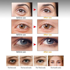 Wrinkle Peptide Serum Eye Massager Skin Care Swelling Dark Circles